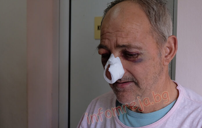 Група роми преби бай Митко от Ощава. Мъжът е в благоевградската болница (СНИМКИ)