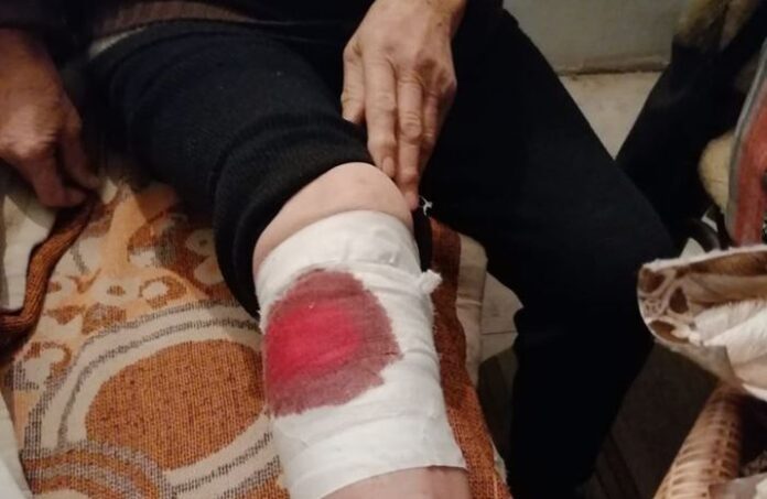 Бездомно куче нахапа 84-годишна жена в Дупница