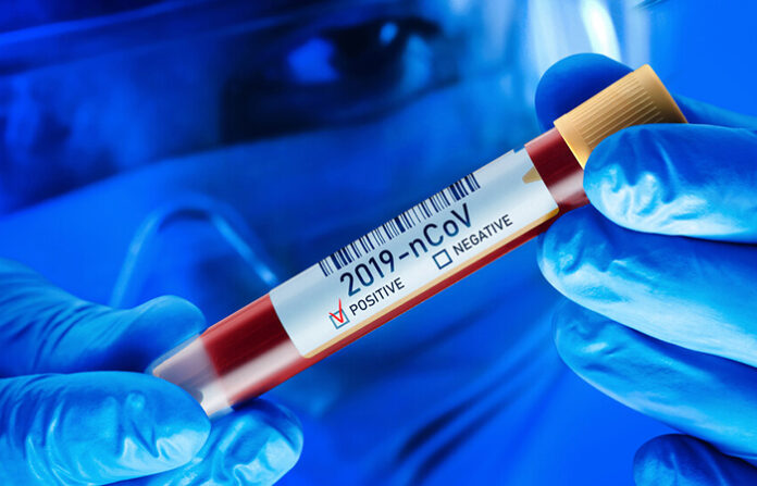 Още 4 случая на COVID-19 у нас