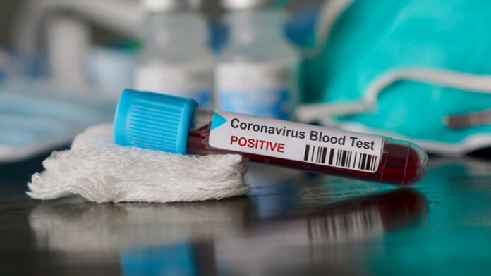593 са потвърдените случаи на COVID-19 у нас, 3 нови в Кюстендил