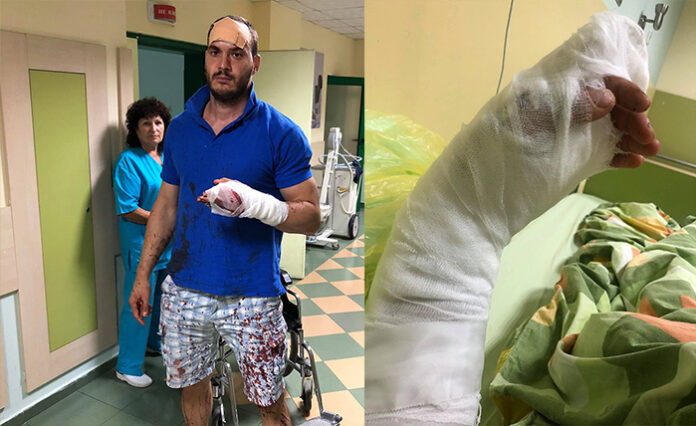 ВМРО: Цигани сякоха с мачете мъж в Роман