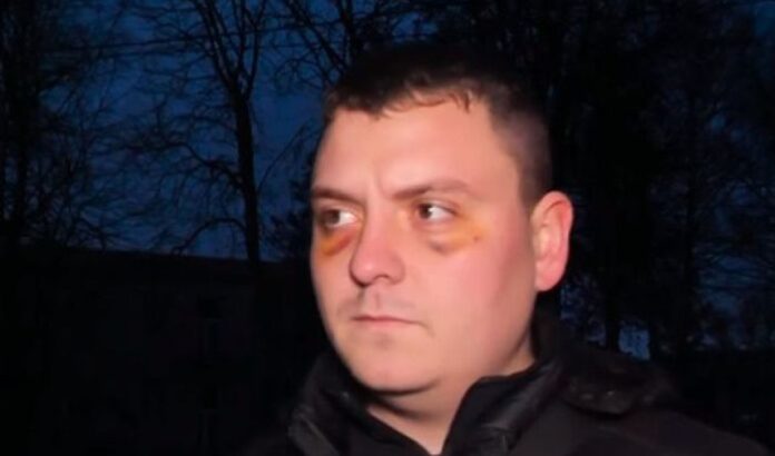 След масовия бой между кукери: Жена загуби бебето си, ранен е 16-годишен младеж