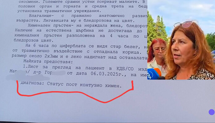 Случаят 